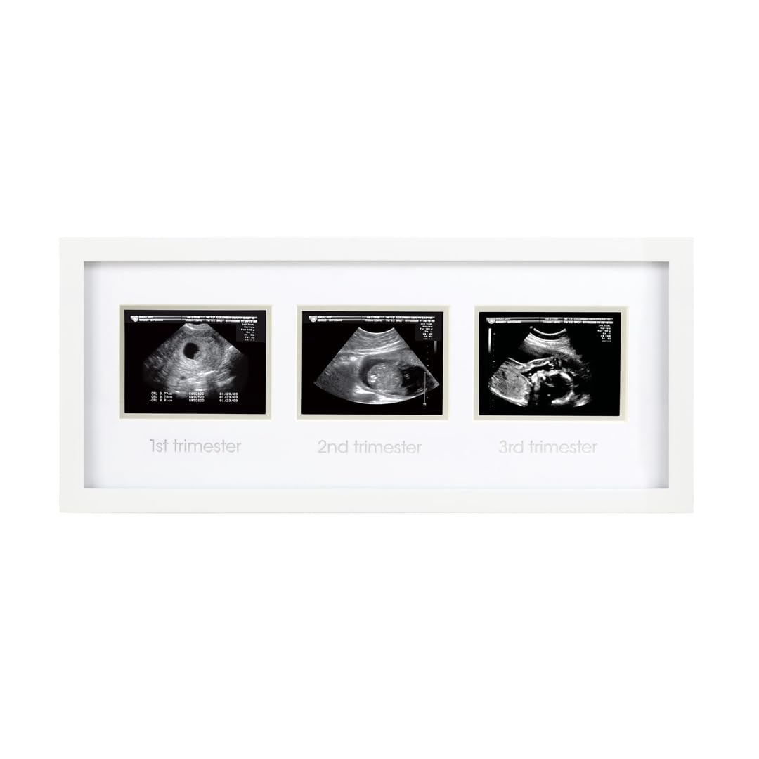 Pearhead 87038 Trimester Sonogram Frame Deluxe, fotoğraf çerçevesi için üç Ultraschallaufnahmen, beyaz