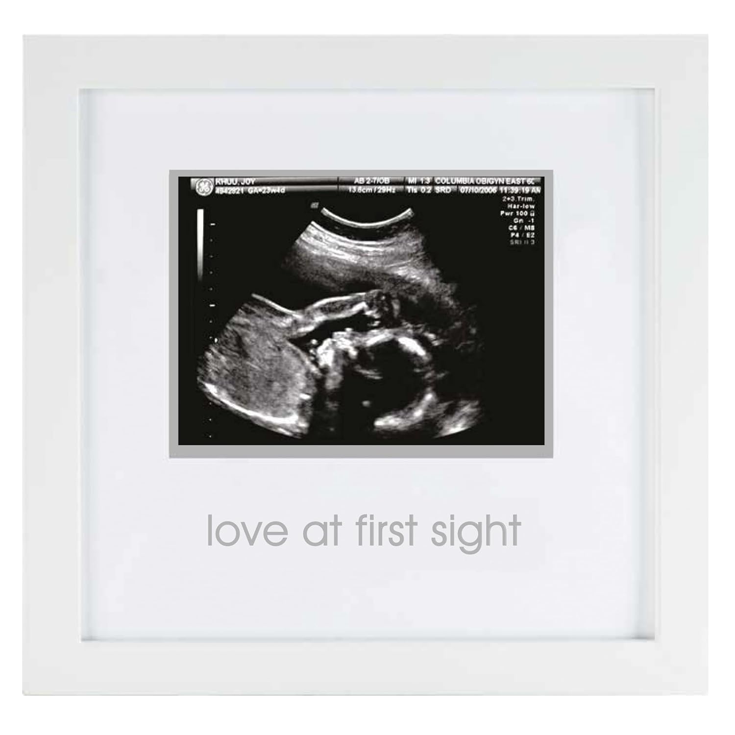 Pearhead İlk Görüşte Aşk Sonogram Resim Çerçevesi, Hamilelik Hatırası Fotoğraf Çerçevesi, Cinsiyetsiz Bebek Odası Dekoru, Anneler Günü Aksesuarı, Beyaz