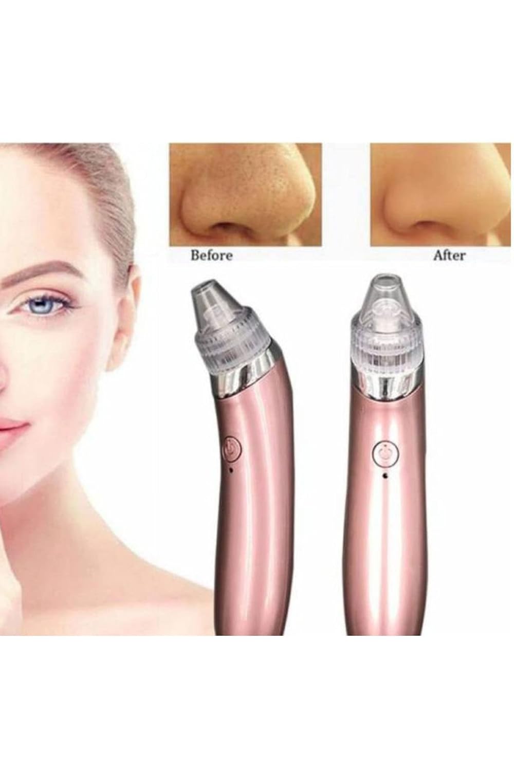 Mobee Profesyonel Vakumlu Siyah Nokta Akne Cilt Temizleme Cihazı