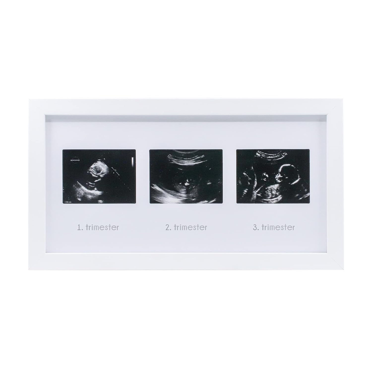 FUFİZU Üçlü Ultrason Anı Çerçevesi - Gebelikte Bebeğin Gelişimini Üç Trimester Anı Olarak Saklayın