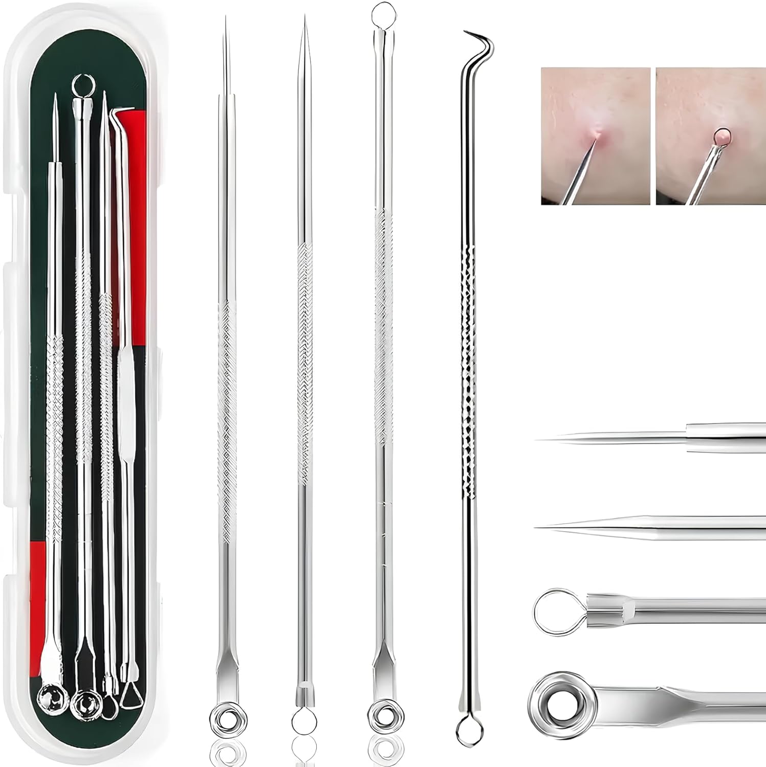 Galori Siyah Nokta Çıkarıcı Aracı Siyah Nokta Remover Sivilce Popper Sivilce Leke için Araç Kiti Komedone Akne Zit Whitehead Yüz Çene Noze Alın Yanak Vücut