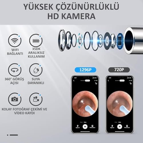 Valkyrie Kablosuz Wifi Kulak Temizleme Kamerası - Ios Android Iphone Uyumlu 1296P HD LED Otoskop Kamera